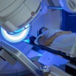 How to cope with side effects of Radiation Therapy?