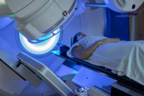 How to cope with side effects of Radiation Therapy?