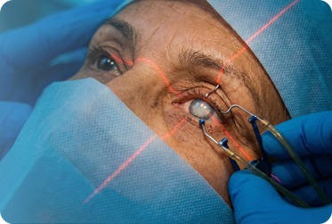 Cataract Surgery Options in 2026: What Every Patient Should Know