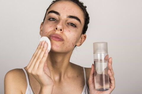 Best Daily Skincare Routine to Prevent Acne and Breakouts