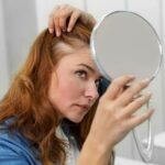Hair Loss